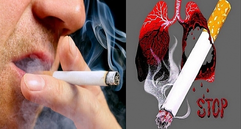 Hút thuốc lá và nguy cơ chuyển biến nặng khi mắc Covid 19
