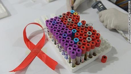 Sau 20 năm, HIV lại phát hiện chủng virus mới